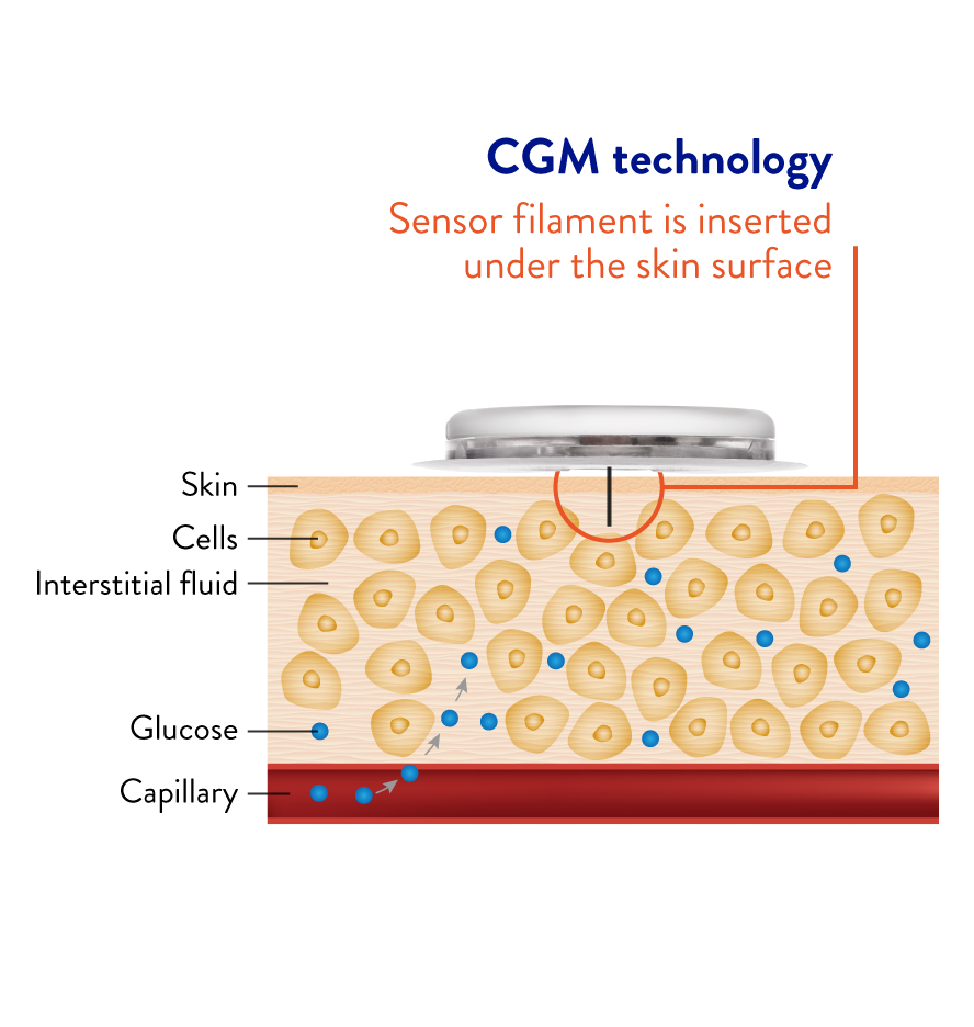 how does freestyle libre cgm technology work