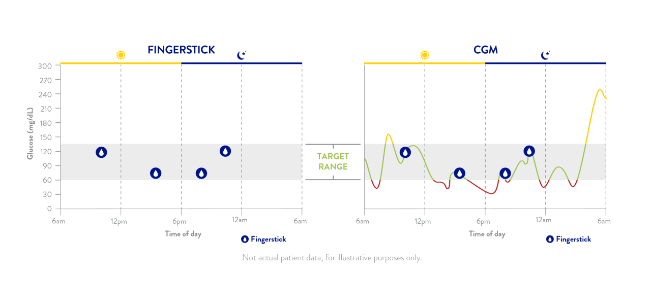 fingerstick vs cgm display comparison